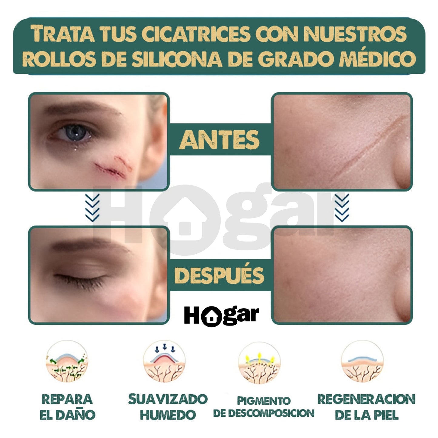 ScarErase™️ – Elimina tus cicatrices sin dolor y recupera tu piel