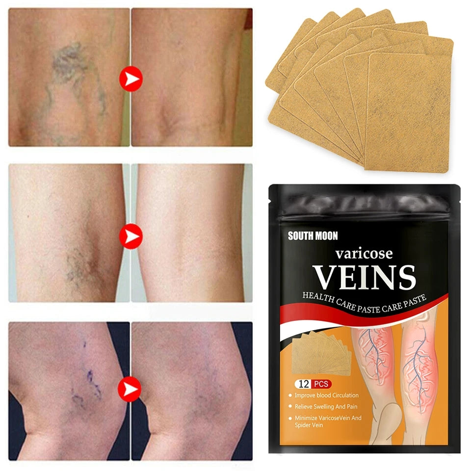 PROMOCIÓN 3X1 Pack de 3 cajas de Parches Naturales para Varices (32 Unidades)